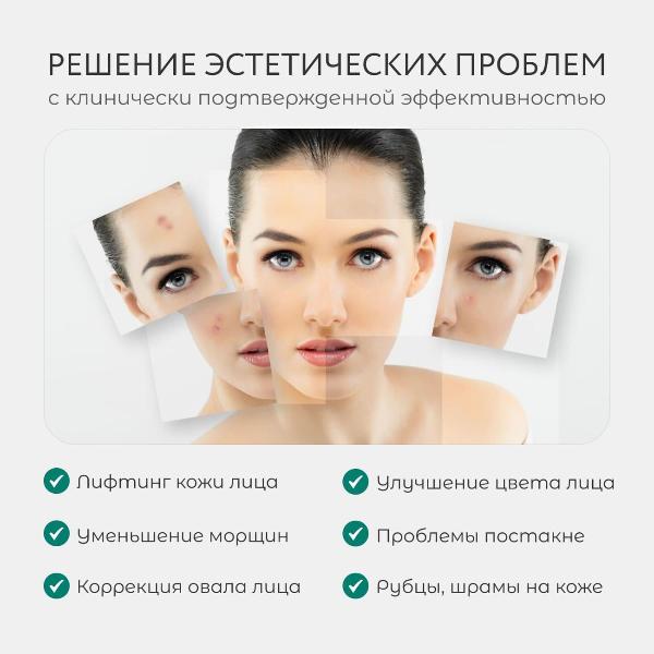 apparatus-for-rf-lifting-gezatone-rf-1610