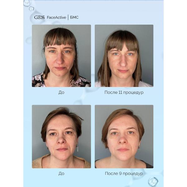 биомеханичеcкий-massager-gess-face-active-8